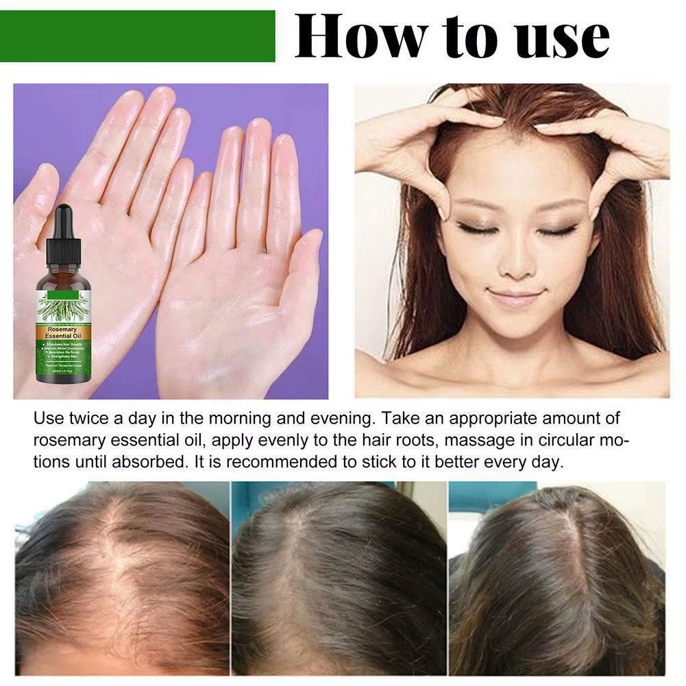 Rosemary Essential Oil for Hair Growth 