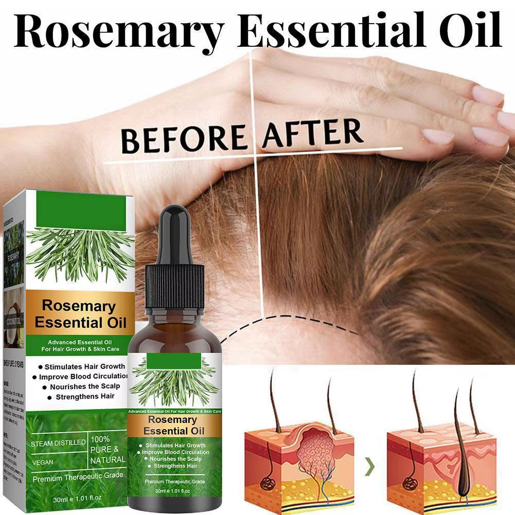Rosemary Essential Oil for Hair Growth 