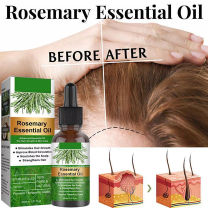 Rosemary Essential Oil for Hair Growth 